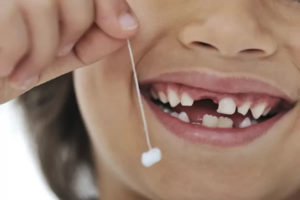 Como agir durante a queda dos dentes de leite da criança?